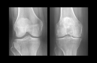 knee x-ray